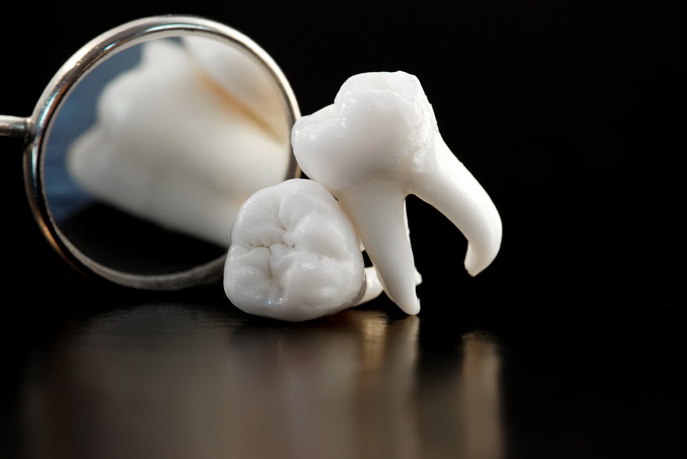 Wisdom Teeth Removal: 8 Tips for a Speedy Recovery