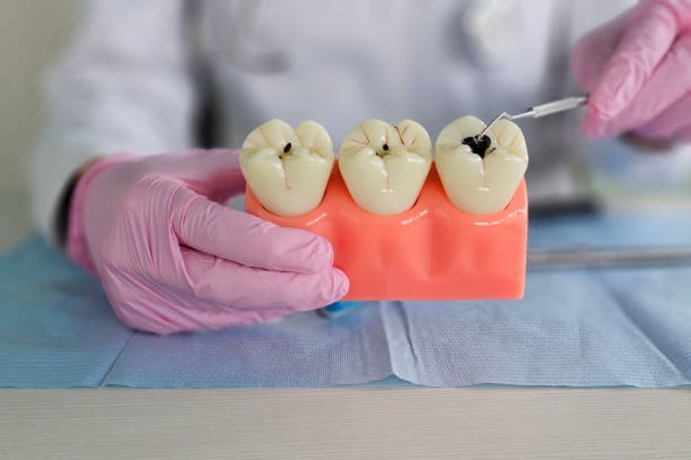 can-you-replace-an-old-or-damaged-filling