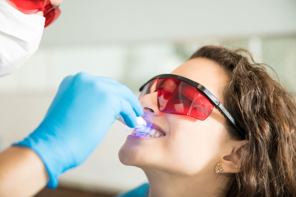 professional teeth whitening vs. at-home kits what's the real difference